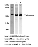 PPARG / PPAR Gamma Antibody - Western blot of PPAR gamma pAb in extracts from HEK293T cells, mouse brain and rat brain tissues.