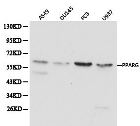 PPARG / PPAR Gamma Antibody - Western blot of PPAR gamma pAb in extracts from A549, DU145, PC3 and U937 cells.