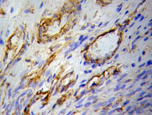 PPARG / PPAR Gamma Antibody - Immunohistochemistry (IHC) analysis of PPAR gamma pAb in paraffin-embedded H-ovary tissue.