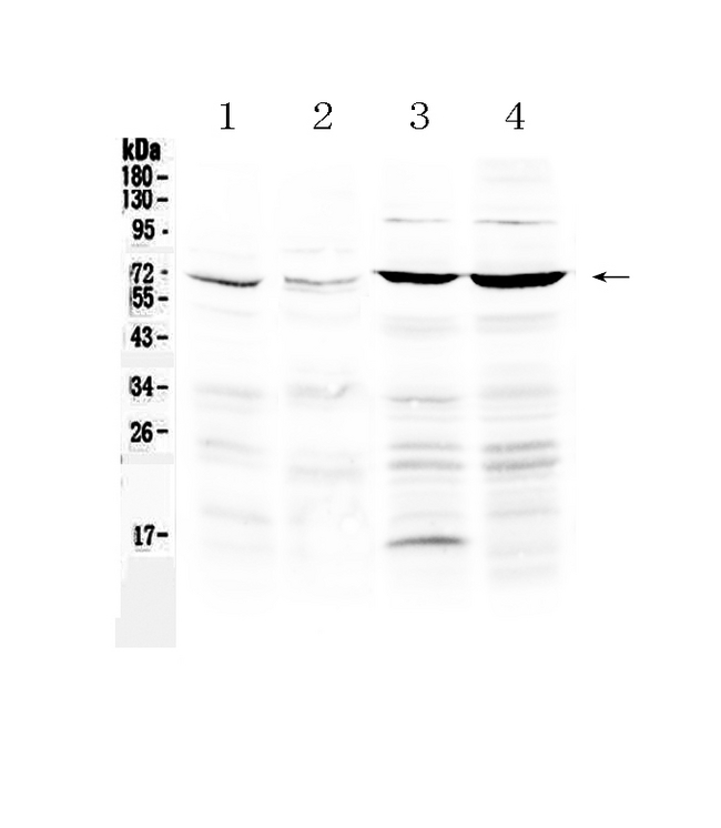 PPARG / PPAR Gamma Antibody - Western blot analysis of PPAR gamma using anti-PPAR gamma antibody. Electrophoresis was performed on a 5-20% SDS-PAGE gel at 70V (Stacking gel) / 90V (Resolving gel) for 2-3 hours. The sample well of each lane was loaded with 50ug of sample under reducing conditions. Lane 1: rat lung tissue lysate,Lane 2: mouse lung tissue lysate,Lane 3: human A549 whole cell lysate,Lane 4: human Hela whole cell lysate. After Electrophoresis, proteins were transferred to a Nitrocellulose membrane at 150mA for 50-90 minutes. Blocked the membrane with 5% Non-fat Milk/ TBS for 1.5 hour at RT. The membrane was incubated with rabbit anti-PPAR gamma antigen affinity purified polyclonal antibody at 0.5 µg/mL overnight at 4°C, then washed with TBS-0.1% Tween 3 times with 5 minutes each and probed with a goat anti-rabbit IgG-HRP secondary antibody at a dilution of 1:10000 for 1.5 hour at RT. The signal is developed using an Enhanced Chemiluminescent detection (ECL) kit with Tanon 5200 system. A specific band was detected for PPAR gamma at approximately 67KD. The expected band size for PPAR gamma is at 58KD.