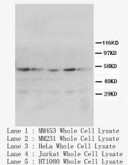PPARG / PPAR Gamma Antibody -  This image was taken for the unconjugated form of this product. Other forms have not been tested.