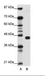 PPARG / PPAR Gamma Antibody - A: Marker, B: Jurkat Cell Lysate.  This image was taken for the unconjugated form of this product. Other forms have not been tested.