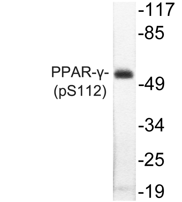 PPARG / PPAR Gamma Antibody - Western blot of p-PPAR (S112) pAb in extracts from Jurkat cells treated with Paclitaxel.