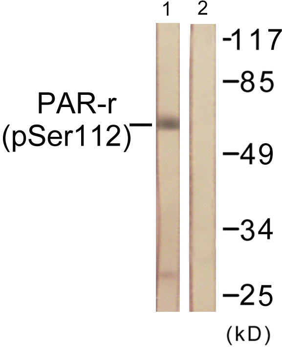 PPARG / PPAR Gamma Antibody - Western blot analysis of lysates from Jurkat cells treated with Paclitaxel 1uM 24h, using PPAR-gamma (Phospho-Ser112) Antibody. The lane on the right is blocked with the phospho peptide.