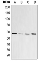 PPARG / PPAR Gamma Antibody - Western blot analysis of PPAR gamma (pS112) expression in HeLa colchicine-treated (A); Raw264.7 colchicine-treated (B); PC12 colchicine-treated (C); U937 (D) whole cell lysates.