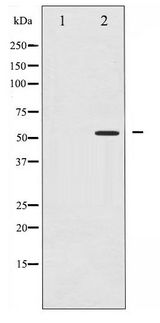 PPARG / PPAR Gamma Antibody - Western blot of PPAR- gamma phosphorylation expression in Paclitaxel treated Jurkat whole cell lysates,The lane on the left is treated with the antigen-specific peptide.