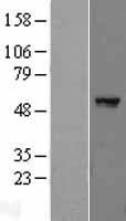 PPARG / PPAR Gamma Protein - Western validation with an anti-DDK antibody * L: Control HEK293 lysate R: Over-expression lysate