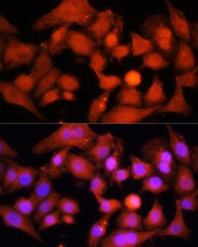 PPARGC1A / PGC-1 Alpha Antibody - Immunofluorescence analysis of HeLa cells using PGC1 alpha Polyclonal Antibody at dilution of 1:100.Blue: DAPI for nuclear staining.