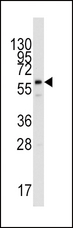 PPAT Antibody - Western blot of anti-PPAT Antibody in HepG2 cell line lysates (35 ug/lane). PPAT(arrow) was detected using the purified antibody.