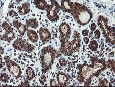 PPAT Antibody - IHC of paraffin-embedded Human breast tissue using anti-PPAT mouse monoclonal antibody. (Heat-induced epitope retrieval by 10mM citric buffer, pH6.0, 120°C for 3min).