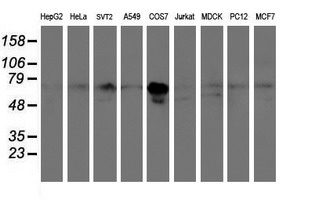 PPAT Antibody - Western blot of extracts (35ug) from 9 different cell lines by using anti-PPAT monoclonal antibody.