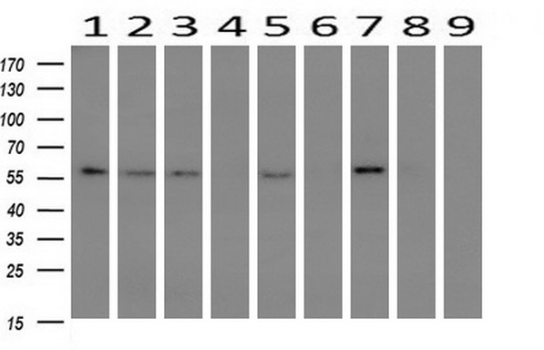 PPAT Antibody - Western blot of extracts (10ug) from 9 Human tissue by using anti-PPAT monoclonal antibody at 1:200 (1: Testis; 2: Omentum; 3: Uterus; 4: Breast; 5: Brain; 6: Liver; 7: Ovary; 8: Thyroid gland; 9: Colon).