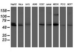 PPAT Antibody - Western blot of extracts (35ug) from 9 different cell lines by using anti-PPAT monoclonal antibody (HepG2: human; HeLa: human; SVT2: mouse; A549: human; COS7: monkey; Jurkat: human; MDCK: canine; PC12: rat; MCF7: human).