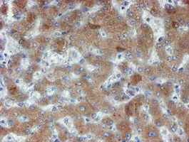 PPAT Antibody - IHC of paraffin-embedded Human liver tissue using anti-PPAT mouse monoclonal antibody. (Heat-induced epitope retrieval by 10mM citric buffer, pH6.0, 100C for 10min).