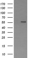 PPAT Antibody - HEK293T cells were transfected with the pCMV6-ENTRY control (Left lane) or pCMV6-ENTRY PPAT (Right lane) cDNA for 48 hrs and lysed. Equivalent amounts of cell lysates (5 ug per lane) were separated by SDS-PAGE and immunoblotted with anti-PPAT.