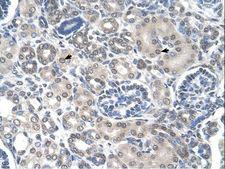 PPAT Antibody - PPAT antibody PPAT(phosphoribosyl pyrophosphate amidotransferase) Antibody was used in IHC to stain formalin-fixed, paraffin-embedded human kidney.  This image was taken for the unconjugated form of this product. Other forms have not been tested.