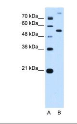 PPAT Antibody - Lane A: Marker. Lane B: HepG2 cell lysate. Antibody concentration: 0.25 ug/ml. Gel concentration: 12%.  This image was taken for the unconjugated form of this product. Other forms have not been tested.