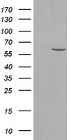 PPAT Antibody - HEK293T cells were transfected with the pCMV6-ENTRY control (Left lane) or pCMV6-ENTRY PPAT (Right lane) cDNA for 48 hrs and lysed. Equivalent amounts of cell lysates (5 ug per lane) were separated by SDS-PAGE and immunoblotted with anti-PPAT.