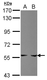 PPAT Antibody - Sample (30 ug of whole cell lysate) A: HepG2 B: HCT116 7.5% SDS PAGE PPAT antibody diluted at 1:1000
