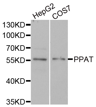 PPAT Antibody - Western blot analysis of extracts of various cell lines.