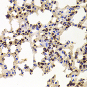 PPAT Antibody - Immunohistochemistry of paraffin-embedded Mouse lung tissue.