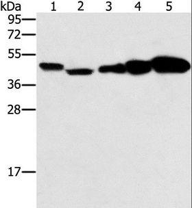PPAT Antibody - Western blot analysis of HeLa, Raji, Jurkat, A549 and NIH/3T3 cell, using PPAT Polyclonal Antibody at dilution of 1:250.