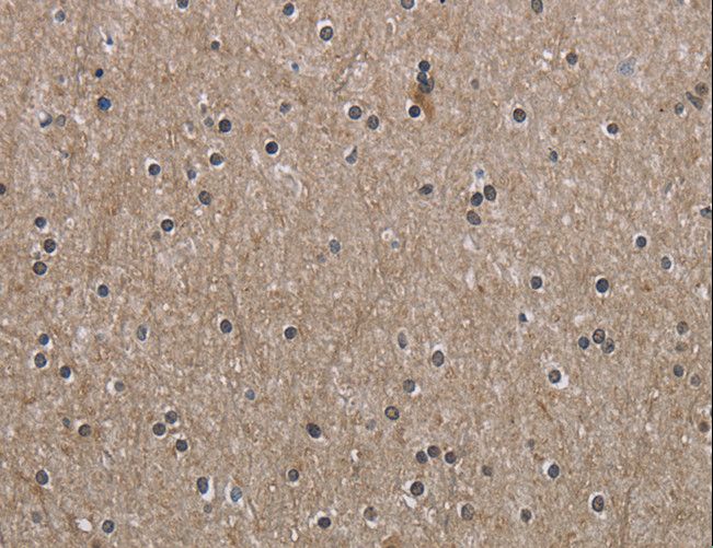 PPAT Antibody - Immunohistochemistry of paraffin-embedded Human brain using PPAT Polyclonal Antibody at dilution of 1:50.