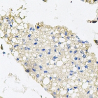 PPAT Antibody - Immunohistochemical analysis of Atase staining in mouse lung formalin fixed paraffin embedded tissue section. The section was pre-treated using heat mediated antigen retrieval with sodium citrate buffer (pH 6.0). The section was then incubated with the antibody at room temperature and detected using an HRP conjugated compact polymer system. DAB was used as the chromogen. The section was then counterstained with hematoxylin and mounted with DPX.