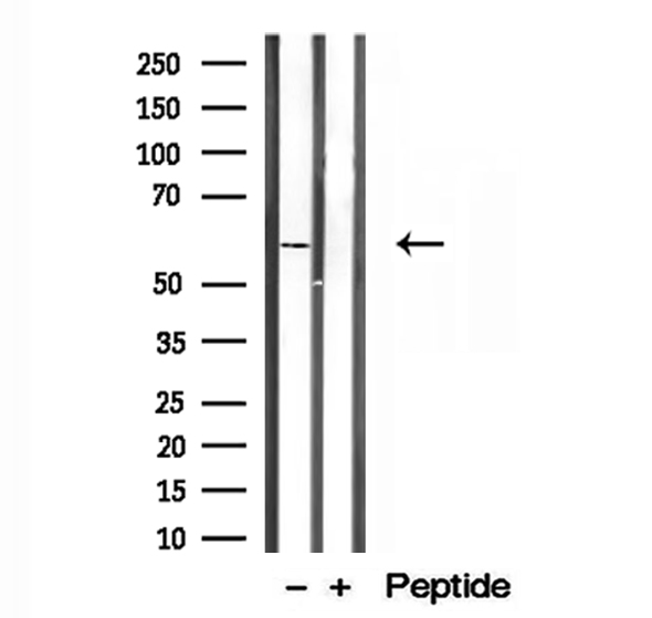 PPAT Antibody - Western blot analysis of extracts of HEK293 cells using PPAT antibody.
