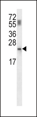 PPCDC Antibody - PPCDC Antibody western blot of mouse kidney tissue lysates (35 ug/lane). The PPCDC antibody detected the PPCDC protein (arrow).