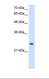 PPCDC Antibody - HepG2 cell lysate. Antibody concentration: 2.5 ug/ml. Gel concentration: 12%.  This image was taken for the unconjugated form of this product. Other forms have not been tested.