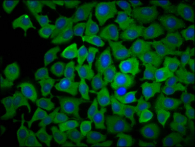 PPCDC Antibody - Immunofluorescence staining of A549 cells diluted at 1:166, counter-stained with DAPI. The cells were fixed in 4% formaldehyde, permeabilized using 0.2% Triton X-100 and blocked in 10% normal Goat Serum. The cells were then incubated with the antibody overnight at 4°C.The Secondary antibody was Alexa Fluor 488-congugated AffiniPure Goat Anti-Rabbit IgG (H+L).