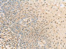 PPCDC Antibody - Immunohistochemistry of paraffin-embedded Human tonsil tissue  using PPCDC Polyclonal Antibody at dilution of 1:55(×200)