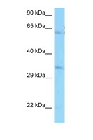 PPCS Antibody - PPCS antibody Western blot of Jurkat Cell lysate. Antibody concentration 1 ug/ml.  This image was taken for the unconjugated form of this product. Other forms have not been tested.