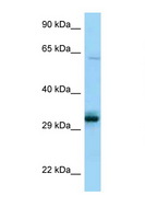PPCS Antibody - PPCS antibody Western blot of HeLa Cell lysate. Antibody concentration 1 ug/ml.  This image was taken for the unconjugated form of this product. Other forms have not been tested.
