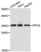 PPCS Antibody - Western blot analysis of extracts of various cell lines, using PPCS antibody at 1:3000 dilution. The secondary antibody used was an HRP Goat Anti-Rabbit IgG (H+L) at 1:10000 dilution. Lysates were loaded 25ug per lane and 3% nonfat dry milk in TBST was used for blocking. An ECL Kit was used for detection and the exposure time was 90s.