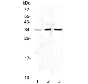 PPCS Antibody - Western blot testing of human 1) HeLa, 2) placenta and 3) PC-3 lysate with PPCS antibody at 0.5ug/ml. Predicted molecular weight ~34 kDa.