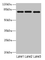 PPEF / PPEF1 Antibody - Western blot All lanes: PPEF1 antibody at 1µg/ml Lane 1: U251 whole cell lysate Lane 2: A549 whole cell lysate Lane 3: Hela whole cell lysate Lane 4: Mouse gonadal tissue Secondary Goat polyclonal to rabbit IgG at 1/10000 dilution Predicted band size: 76, 70, 73, 45, 69 kDa Observed band size: 76 kDa