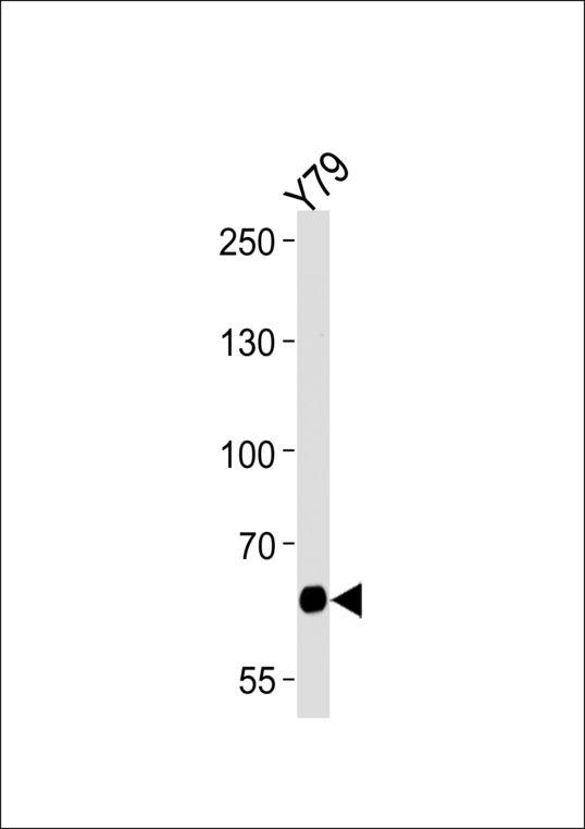 PPEF2 Antibody - Western blot of lysate from Y79 cell line, using PPEF2 Antibody. Antibody was diluted at 1:1000 at each lane. A goat anti-rabbit IgG H&L (HRP) at 1:5000 dilution was used as the secondary antibody. Lysate at 35ug per lane.