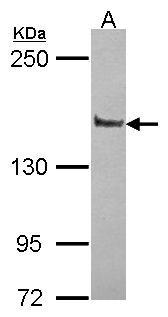 PPFIA1 / LIPRIN Antibody - Sample (30 ug of whole cell lysate). A: JurKat. 5% SDS PAGE. PPFIA1 / LIPRIN antibody diluted at 1:10000.