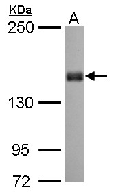 PPFIA1 / LIPRIN Antibody - Liprin alpha 1 antibody [N1N2], N-term detects PPFIA1 protein by Western blot analysis. A. 30 ug Neuro2A whole cell lysate/extract. 5 % SDS-PAGE. Liprin alpha 1 antibody [N1N2], N-term dilution:1:1000