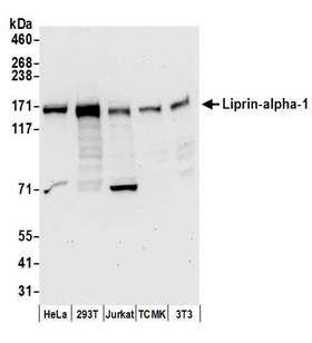 PPFIA1 / LIPRIN Antibody - Detection of human and mouse Liprin-alpha-1 by western blot. Samples: Whole cell lysate (50 µg) from HeLa, HEK293T, Jurkat, mouse TCMK-1, and mouse NIH 3T3 cells prepared using NETN lysis buffer. Antibodies: Affinity purified rabbit anti-Liprin-alpha-1 antibody used for WB at 0.1 µg/ml. Detection: Chemiluminescence with an exposure time of 30 seconds.