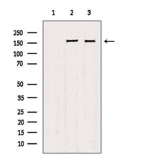 PPFIA1 / LIPRIN Antibody - Western blot analysis of extracts of various samples using Liprin alpha 1 antibody. Lane 1: 293 treated with blocking peptide. Lane 2: 293; Lane 3: HeLa;