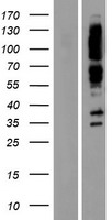PPFIA1 / LIPRIN Protein - Western validation with an anti-DDK antibody * L: Control HEK293 lysate R: Over-expression lysate