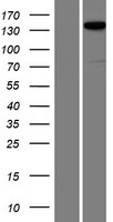 PPFIA2 Protein - Western validation with an anti-DDK antibody * L: Control HEK293 lysate R: Over-expression lysate