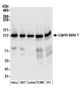 PPFIBP1 Antibody - Detection of human and mouse Liprin beta 1 by western blot. Samples: Whole cell lysate (50 µg) from HeLa, HEK293T, Jurkat, mouse TCMK-1, and mouse NIH 3T3 cells prepared using NETN lysis buffer. Antibodies: Affinity purified rabbit anti-Liprin beta 1 antibody used for WB at 0.1 µg/ml. Detection: Chemiluminescence with an exposure time of 10 seconds.