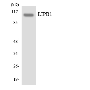 PPFIBP1 Antibody - Western blot analysis of the lysates from COLO205 cells using LIPB1 antibody.