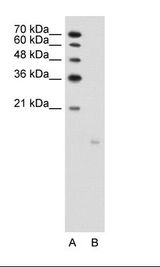PPFIBP1 Antibody - A: Marker, B: Jurkat Cell Lysate.  This image was taken for the unconjugated form of this product. Other forms have not been tested.