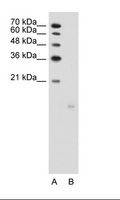 PPFIBP1 Antibody - A: Marker, B: Jurkat Cell Lysate.  This image was taken for the unconjugated form of this product. Other forms have not been tested.