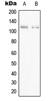 PPFIBP1 Antibody - Western blot analysis of PPFIBP1 expression in Jurkat (A); HEK293T (B) whole cell lysates.